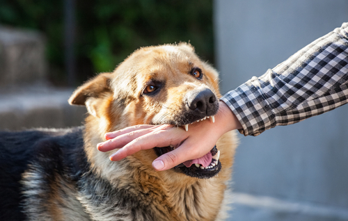 In Need of Dog Bite Lawyer in Dayton Ohio Does Ohio Law Make Dog Owners Pay Without Proving Negligence in Dayton?
