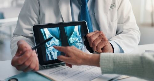 doctor holding tablet displaying knee joint X-ray images during patient consultation
