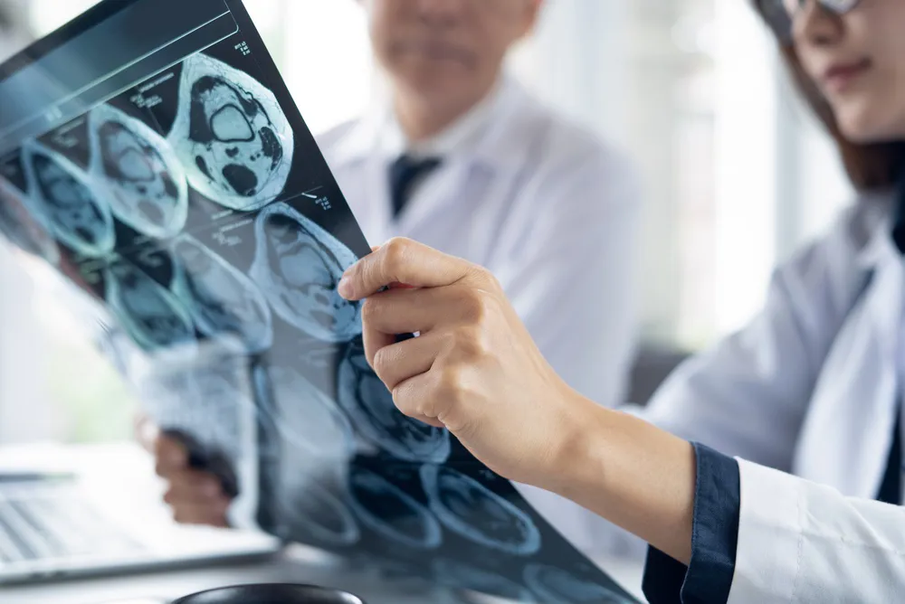 doctors in white coats examining CT scan film together closely